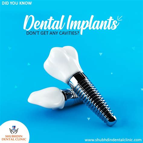 Can i get free dental implants. Dental implants are made up of titanium, so they don't get ...