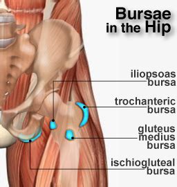 It usually occurs during vigorous sport activity. Iliopsoas Bursitis - Causes, Symptoms and Treatment | Bone ...