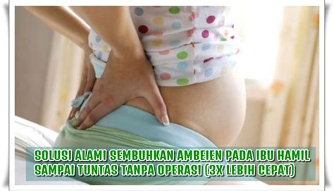 Check spelling or type a new query. Cara Mengatasi Ambeien Pada Ibu Hamil 100% Aman & Efektif ...