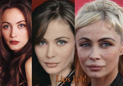 The emmanuellebeart community on reddit. Emmanuelle Beart Plastic Surgery of Lips Job | Top ...