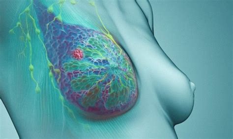 The stage is used to decide what treatment options are recommended. Terminal breast cancer can be wiped out by tweaking an ...