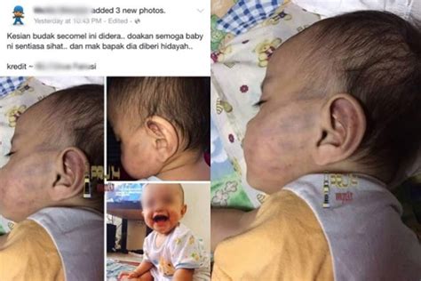 6 kes pembuangan bayi yang paling kejam di malaysia. Wajah Pengasuh Dera Bayi Sampai Lebam Muka & Berbirat Biru ...