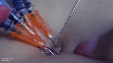 Do not put the needle cap back on. Crazy needle belly button-Nancy - bellycool