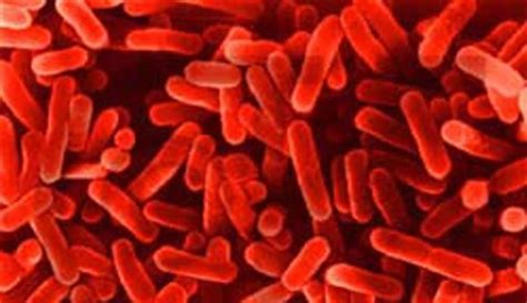 Legionella bacteria can also cause a less serious illness called pontiac fever. Belgische legionella-uitbraak roept vragen op over ...