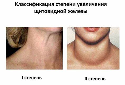Диета при диффузных изменениях печени
