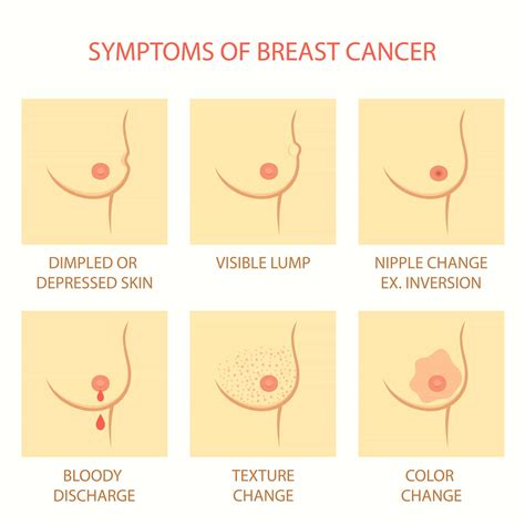 Thickening or swelling of part of the breast. Breast Cancer Awareness 2015: Signs, Symptoms and Risk ...
