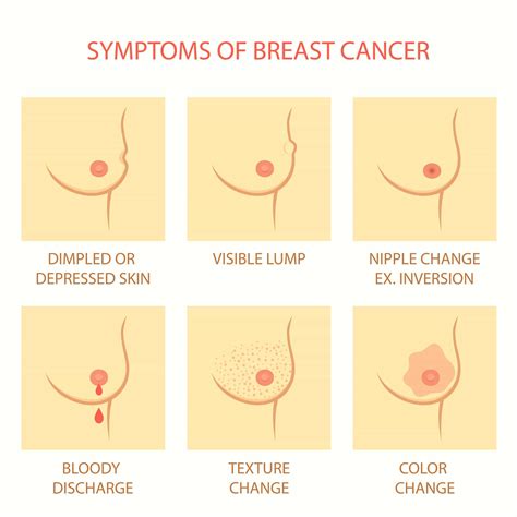 Types of breast cancer, inflammatory breast cancer & stages. Breast Cancer Awareness 2015: Signs, Symptoms and Risk ...