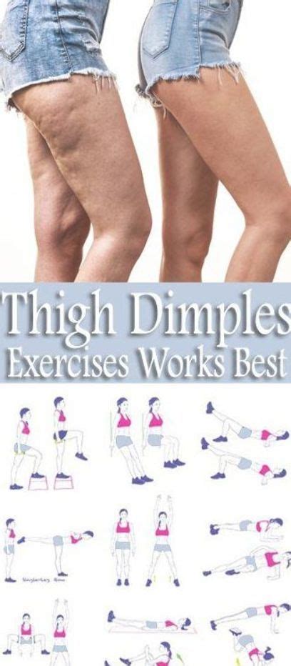 Dimples add some charm to their owners but, in fact, they are caused by a small defect of the muscles. 8 Simple & Best Exercises To Get Rid Of Thigh Dimples - In ...