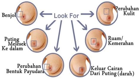 Disamping dugaan kanker payudara, ada beberapa kasus benjolan fibroadenoma tidak terasa sakit, dan jika ditekan akan bergeser. Obat Benjolan Di Payudara - ERIS HERBAL