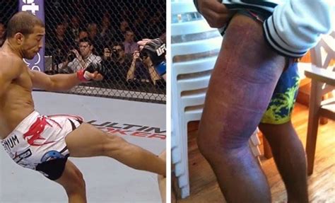 Controversial mma fighter conor mcgregor was beaten again by dustin poirier at ufc 264. Jose Aldo's Hilarious Response When They Asked Him What ...