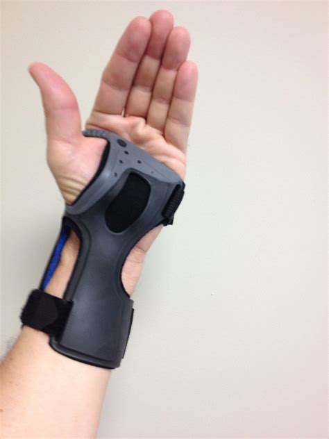 Similar to carpal tunnel syndrome, tendonitis is also caused by repetitious activities involving the hands and wrist. Ossur Exoform Carpal Tunnel Wrist Brace Support Tendonitis ...