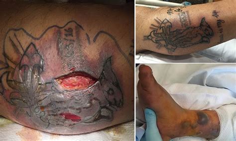 Check spelling or type a new query. This Tattoo Horror Story Is Proof You REALLY Need to Heed ...