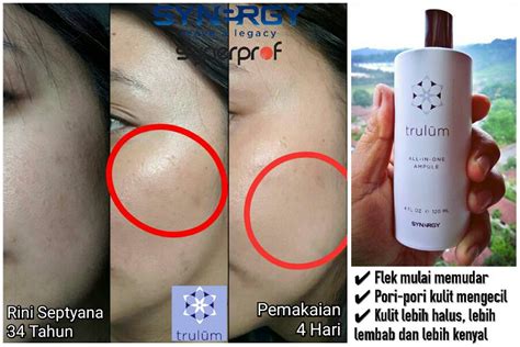 Premium skin care by synergy 8/30/2017 read (words) edit skin is miraculous. Trulum Review / How Can I Prepare For The Sift Trivium ...