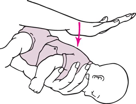 Heimlich manevrası olarak adlandırılan ve solunum yolunun yemek ya da yabancı bir cisimle tıkanması sonucu boğulmayı engellemek için kullanılan tekniktir. Bebek ve Çocuklarda Boğaza Kaçan Cisim Nasıl Çıkartılır ...