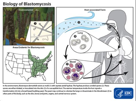 Blood work and urine testing can be used to assess organ dysfunction and sometimes for diagnosis; Traveling Small with a Nucleus: It's a Fungus-Eat-Dog ...