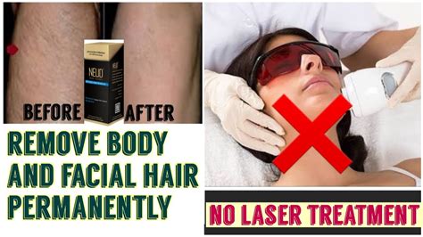 With facial hair inhibitor your hair gradually becomes thinner and thinner as long as you use it. Remove Body And Facial Hair Permanently / Hair Will NEVER ...