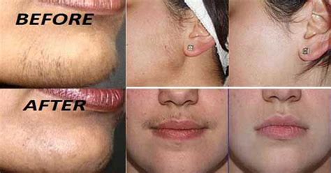 Here are 3 tips to slowing facial hair growth: Pin on beauté