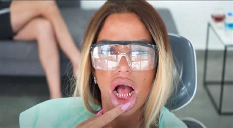 Katie price se operó las lolas ¡por séptima vez! Como tiburón: La nueva tendencia de afilarse los dientes ...