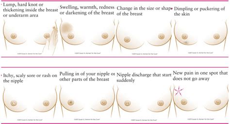 Read more to know if you are having this condition. How To Know That You Have Breast Cancer | MedicineBTG.com