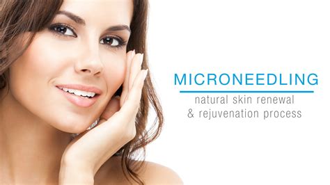 According to a 2008 study, skin treated. Shedding Microneedling / Hyperpigmentation Archives Slk ...