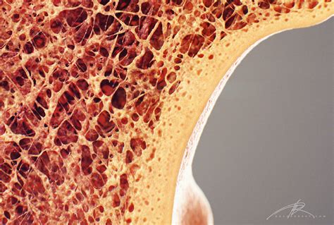 Cross section through an model of an fracture in the neck of the femur (thigh bone). "Bone Cross Section" for Radius Digital Science on Behance