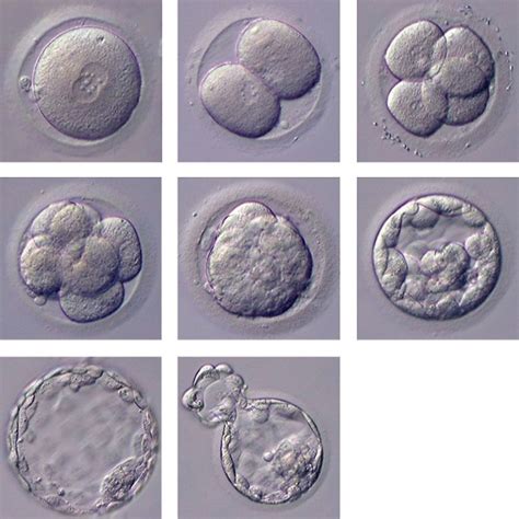 Wenn eine befruchtung stattfindet, muss sich die eizelle noch in die gebärmutterschleimhaut einnisten, damit man wirklich von einer schwangerschaft sprechen kann. Bild zu: Befruchtung: Väterliche Mitochondrien werden ...