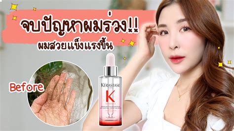 Buy kérastase hair serums & oils and get the best deals at the lowest prices on ebay! จบปัญหาผมร่วง หนังศีรษะ แห้งคันด้วย Kerastase Genesis Anti ...