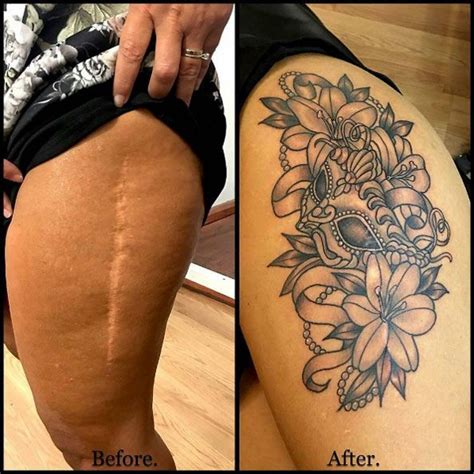 With that said, sick ideas for. 30+ Beautiful Scar-Concealing Tattoo Designs | Tattoo ...