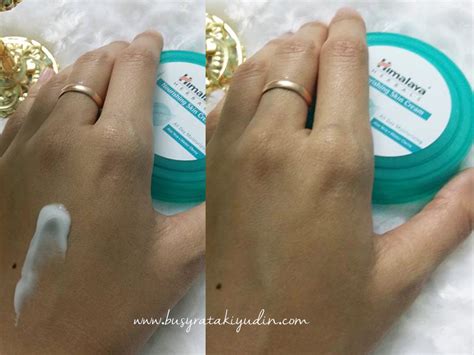 Kulat kaki adalah sangat biasa dan penyakit yang tidak menyenangkan, yang tersebar titisan. NOURISHING SKIN CREAM HIMALAYA DIPERKAYA DENGAN KHASIAT ...