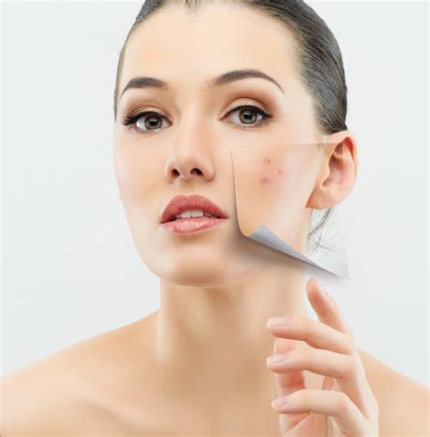 Grundsätzlich meint die microdermabrasion eine bewusste und kontrollierte auch zuhause durchführbar. Microdermabrasion peeling