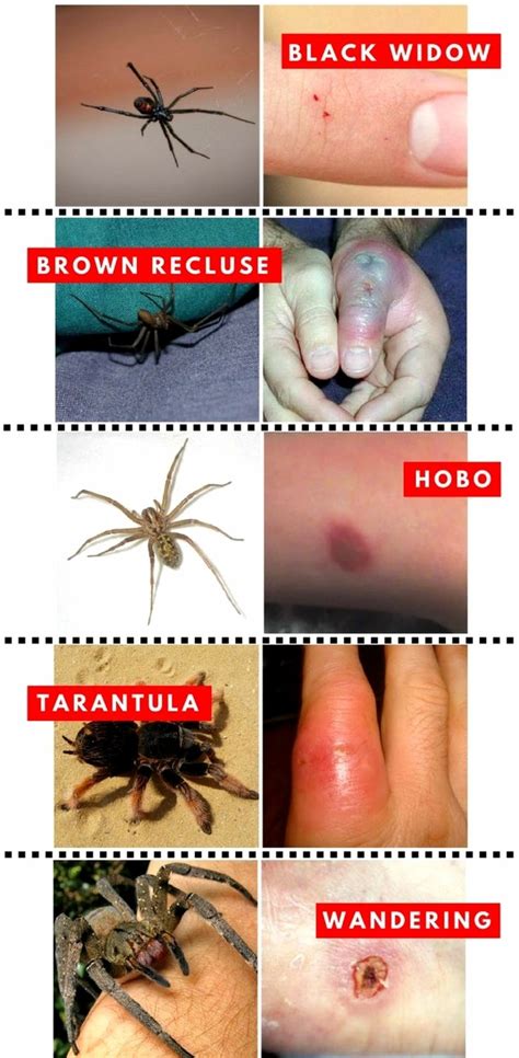 Females range in size from. What does a spider bite look like? - Quora