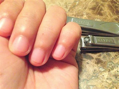 Make sure that, you don't have any broken wire inside your mouth. Life's Perception & Inspiration: Clyppi Nail Clipper Set ...