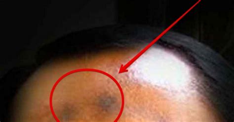 Abdullah bin umar bin khattab ra. Shalatlah Yang Khusyuk dan Hindarilah Tanda Hitam Di Jidat ...