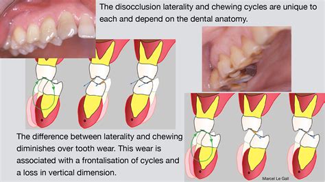 There are four different boolean functions available to examine the spatial context of the geometry of the current shape: Fig C 25 1 E - THE OCCLUSAL FUNCTION