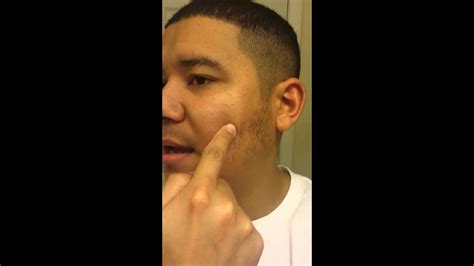 Hair growth involves three stages. Week 2 on minoxidil for facial hair - YouTube