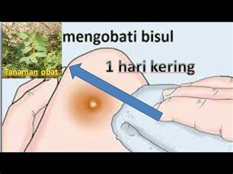 Kondisi ini ditandai dengan adanya kantung berisi nanah dalam jaringan tubuh. Cara Mengobati Bisul - Dunia Herbal