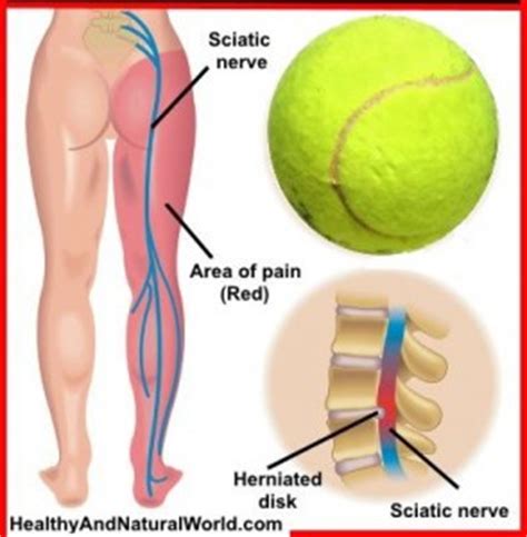 A tennis racquet, like a baseball or cricket bat, has a sweet spot. How to Use Tennis Ball to Relieve Sciatic Pain and Back Pain