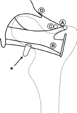 Hip bony bits, pelvis and ligaments. b . Line drawing of the left hip posterior ligaments. A ...