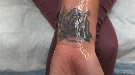 While there are a number of different methods that have been used to remove tattoos in the past, by far the most popular and effective is laser tattoo removal. Gang tattoo removal program expands to help human ...