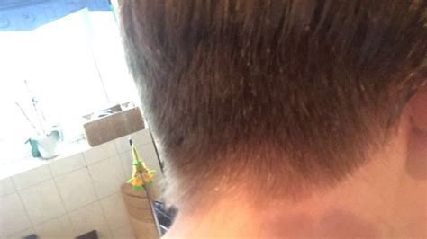 Pflegeleichte kurze frisur mit fedriger struktur im nacken. Nacken ausrasieren lassen bis auf 5 mm? (Friseur, haare-ab ...