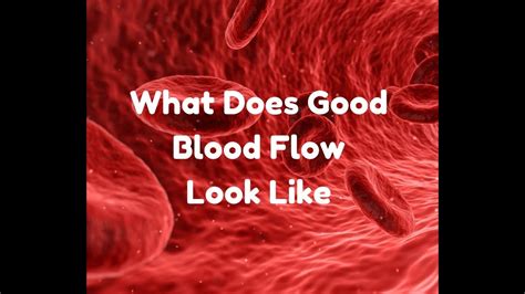 Sinatra, m.d., f.a.c.c., f.a.c.n., c.n.s., c.b.t. What Does Good Blood Flow Look Like? - YouTube