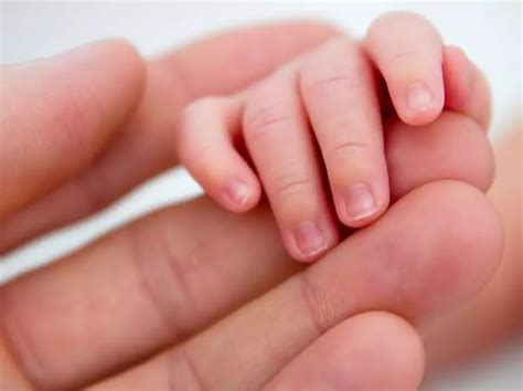 Bayi kuning tipe fisiologis ini biasanya muncul pada bayi di hari kedua atau ketiga setelah kelahiran, dan akan hilang setelah hari ketujuh setelah kelahiran. 5 Cara Mengatasi Jika Bayi Demam Di Rumah - orangmuo.my