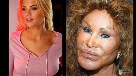 These celebrities before and after their big breaks might look like entirely different people. 10 Celebrity Before-And-After Plastic Surgery Disasters