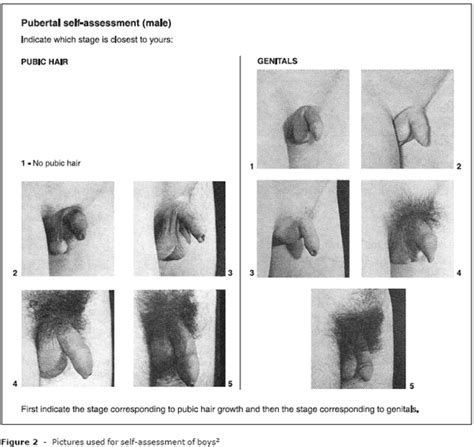 Surgical removal of ingrown pubic hair can trigger infection and hyperpigmentation and as such, should be carried it can irritate such skin type further. I just turned 13, I have been trying to ejaculate since I ...