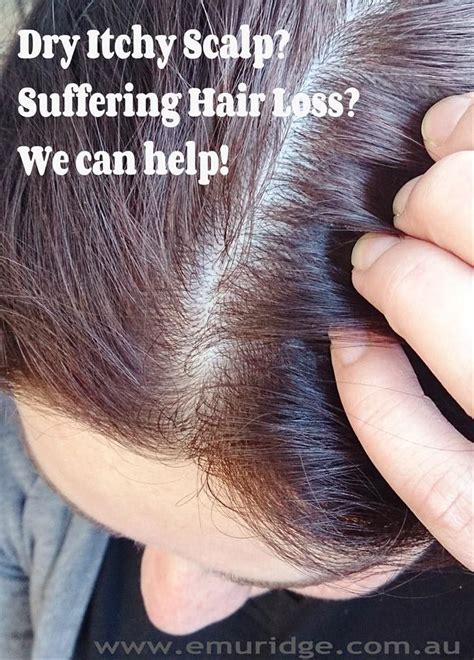 The emu oil comes from the thick pad of fat on an emu's back. Emu Oil for Hair Loss & Dry Scalp and so much more | Emu Ridge