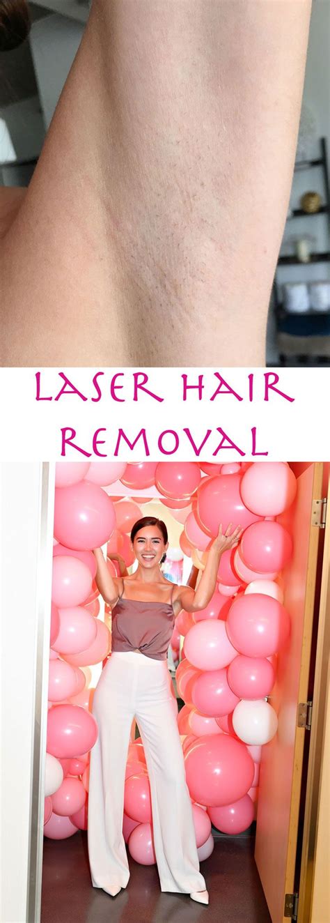 (depending on where in the country you live, a single session on the upper lip area can cost around $150, and up to. Laser hair removal: all you need to know about the hair ...