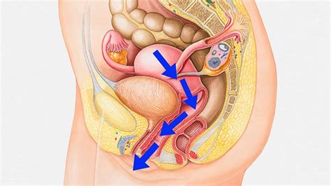 Denn rund um die schönste sache der welt entstehen zahlreiche unsicherheiten, besonders dann, wenn die werdenden eltern beim geschlechtsverkehr naturgemäß. Gebärmuttersenkung: Auf diese Symptome müssen Frauen achten