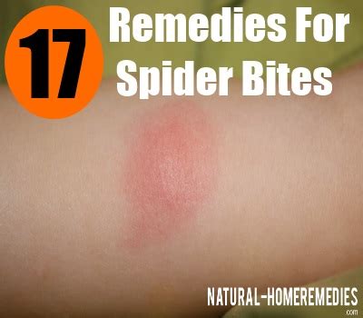 Emergency medical care must be sought at the earliest. Best Treatment For Spider Bites - How To Treat Spider ...