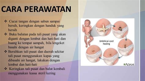 Tali pusat yang ada pada bayi akan menjadi kering, berubah warna dan mengecut. perawatan tali pusat | Perawatan, Tali