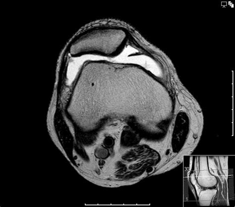 Maybe you would like to learn more about one of these? Knie